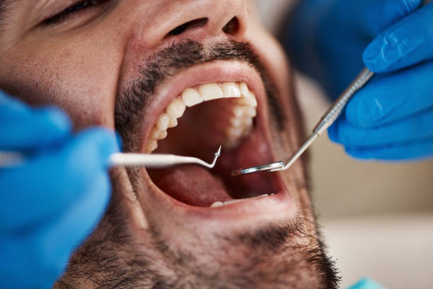 Best Emergency Root Canal Treatment in Batesville, IN